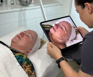eCO2 Fractional Skin Resurfacing Full Face $1500