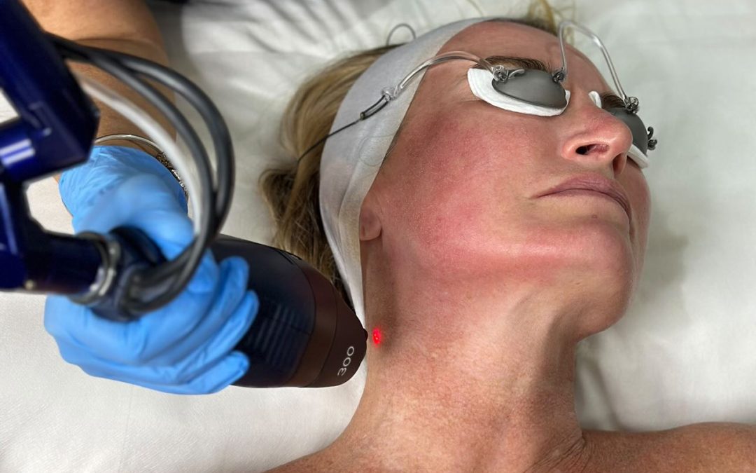 Eco Tone $399 Full Face + Neck